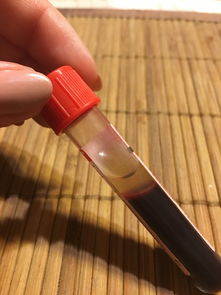 最好的加厚塑料铲子品牌大解析